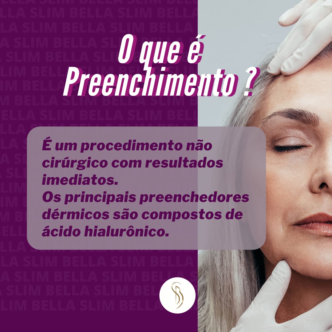 O que é? Preenchimento